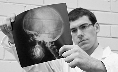 Bodily Injury Claims and Following Your Doctor’s Orders