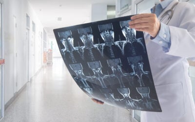Spinal Cord Injuries and Car Accidents